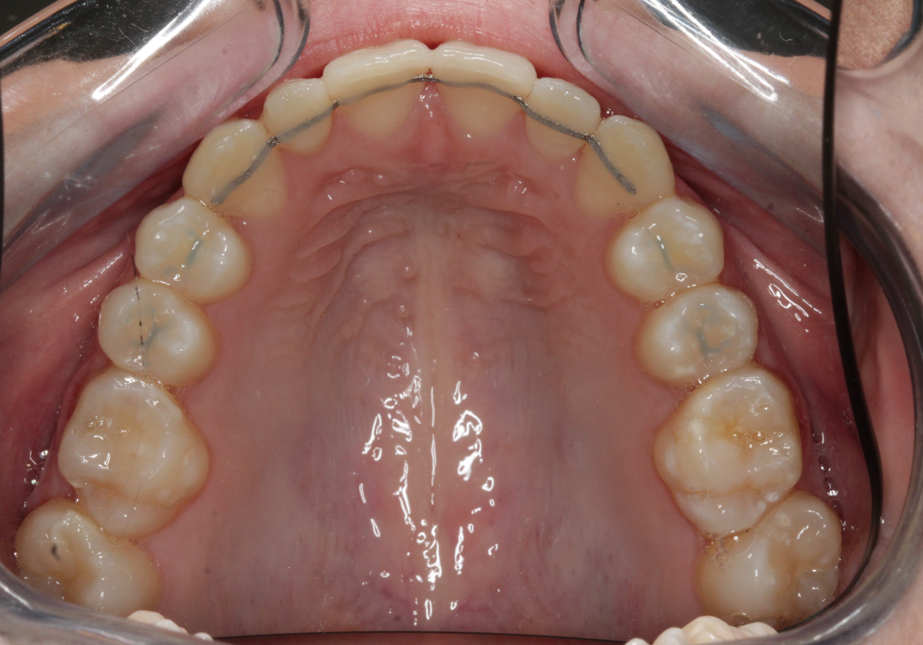 Case3-hyrax-3