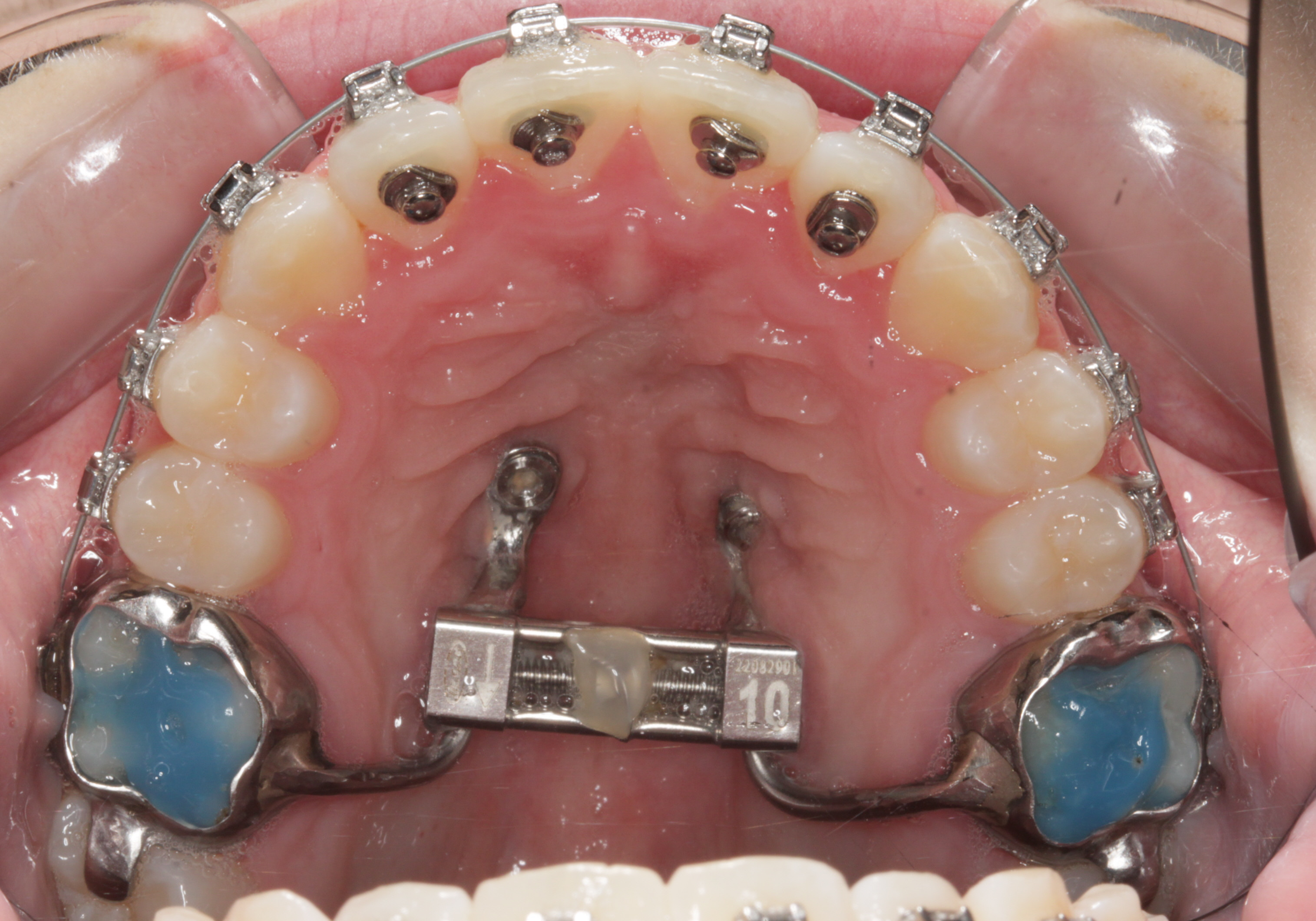 hyrax-case2-8