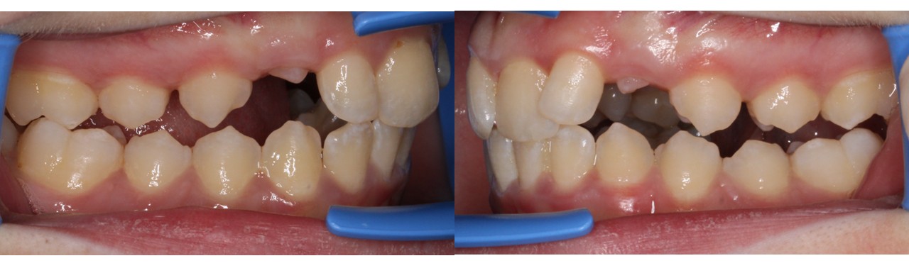 Slide6